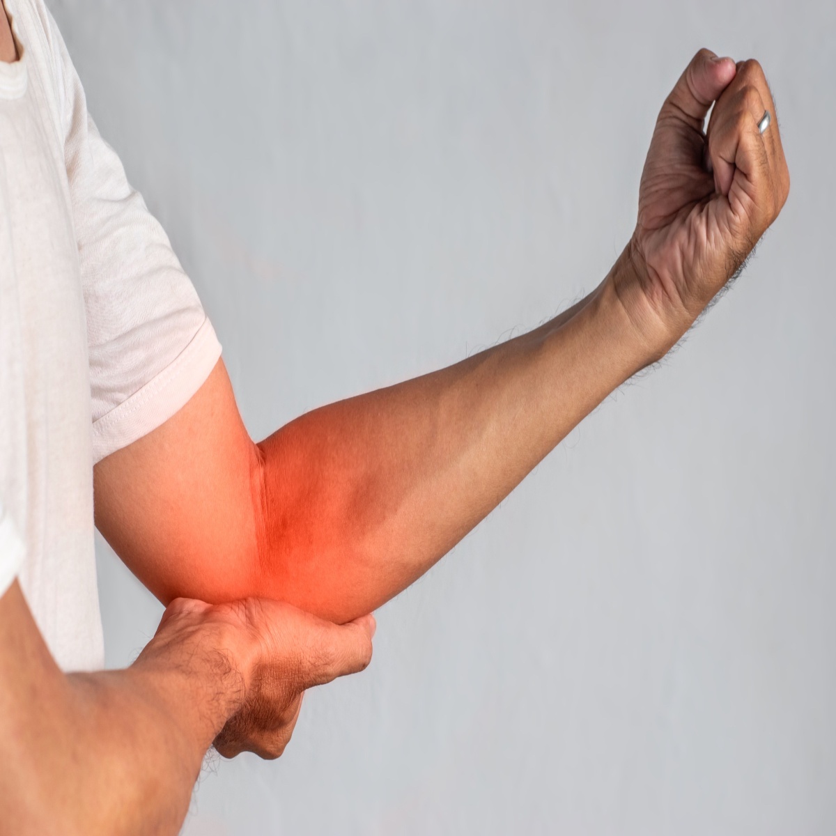 Living with Cubital Tunnel Syndrome: What Patients Should Know
